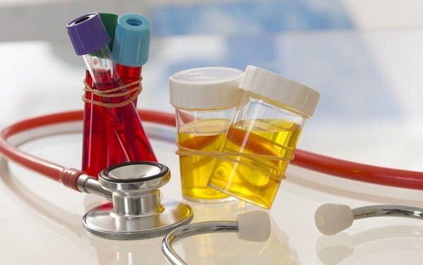 Parazītu diagnoze