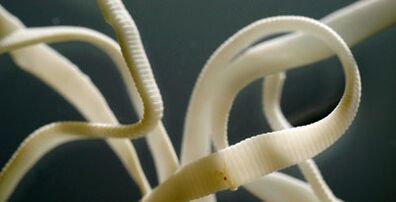 plakans parazīts no cilvēka ķermeņa