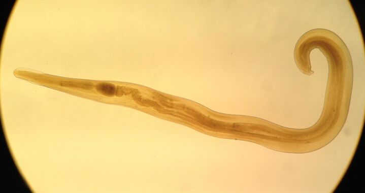 Pinworms ir izplatīts apaļo parazītu veids, kas izraisa enterobiāzi.